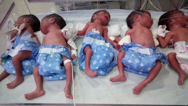 छत्तीसढ़: छह महीने में प्रिमैच्योर डिलिवरी, 25 साल की महिला ने एक साथ दिया पांच बेटियों को जन्म