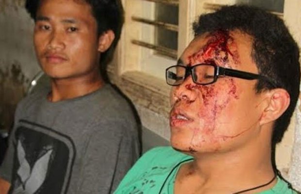 In Bangalore Manipuri boy attacked
