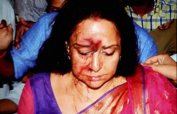 हेमा मालिनी, हेमा मालिनी घायल, सड़क दुर्घटना, दौसा, राजस्‍थान, हेमा मालिनी कार हादसा, बीजेपी, भाजपा, बॉलीवुड, बीजेपी सांसद, भाजपा सांसद, बॉलीवुड न्यूज़, बॉलीवुड खबरें, मनोरंजन, hema malini, bharatiya janata party, BJP MP hema Malini, Mathura MP hema malini, hema malini accident, hema malini news, hema malini road accident, hema malini health, jaipur hema malini accident, Dausa hema malini accident, hema malini injured, hema malini hospital, hema malini mercedes accident, hema malini news, entertainment news