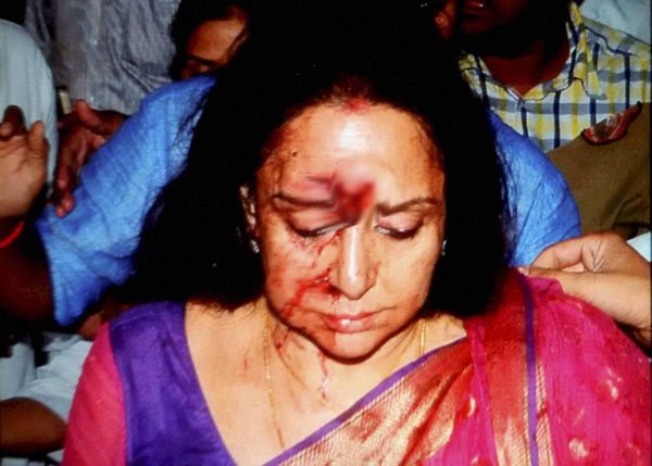 हेमा मालिनी, हेमा मालिनी घायल, हेमा मालिनी सड़क हादसा, हेमामालिनी, सड़क दुर्घटना, दौसा, राजस्‍थान, हेमा मालिनी कार हादसा, हेमा मालिनी के फोटो, बीजेपी, भाजपा, बॉलीवुड, बीजेपी सांसद, भाजपा सांसद, बॉलीवुड न्यूज़, बॉलीवुड खबरें, मनोरंजन, Hema Malini, hema malini accident, hema malini news, accident, Bharatiya Janata Party, hema malini car accident, hema malini injured, BJP MP hema malini, jaipur car accident