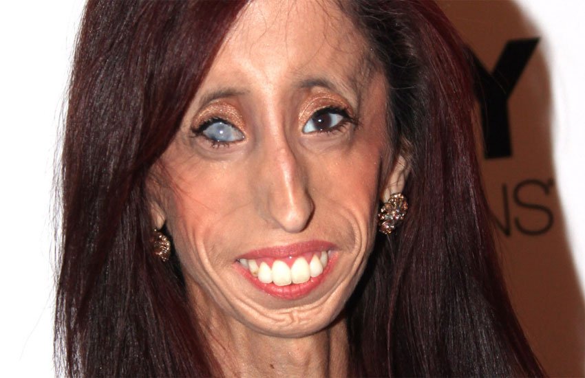 lizzie velasquez, documentary, lizzie velasquez ugly girl, lizzie velasquez heroine, लिज़ी विलेसकेज़, लिज़ी विलेसकेज़ बदसूरत लड़की, बदसूरत' लड़की, लिज़ी विलेसकेज़ हीरोइन, अ ब्रेव हार्ट- द लिज़ी वेलासक्वेज स्टोरी lizzie velasquez, documentary, lizzie velasquez ugly girl, lizzie velasquez heroine, लिज़ी विलेसकेज़, लिज़ी विलेसकेज़ बदसूरत लड़की, बदसूरत' लड़की, लिज़ी विलेसकेज़ हीरोइन, अ ब्रेव हार्ट- द लिज़ी वेलासक्वेज स्टोरी