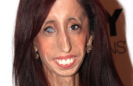 lizzie velasquez, documentary, lizzie velasquez ugly girl, lizzie velasquez heroine, लिज़ी विलेसकेज़, लिज़ी विलेसकेज़ बदसूरत लड़की, बदसूरत' लड़की, लिज़ी विलेसकेज़ हीरोइन, अ ब्रेव हार्ट- द लिज़ी वेलासक्वेज स्टोरी