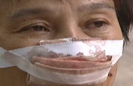 china man nose, china man bites wife nose, chinese man bites nose, chinese man bites nose, husband, wife, nose, call, police, चीन