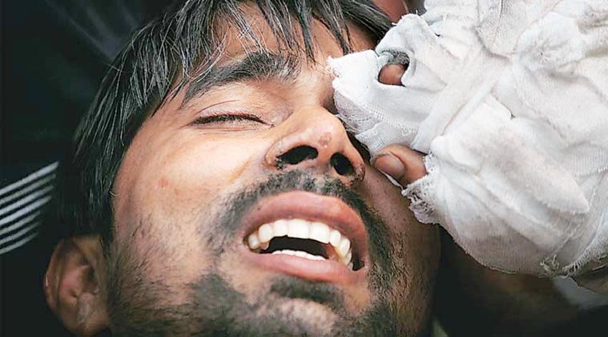 dalit, dalit killing, faridabad, faridabad latest news, dalit killing Photos, news in hindi, hindi news, sunperh, dalit home on fire, dalit family fire, ballabhgarh, haryana, haryana news, dalit family, india news, दलित, दलित हत्या, फरीदाबाद, राजनाथ सिंह