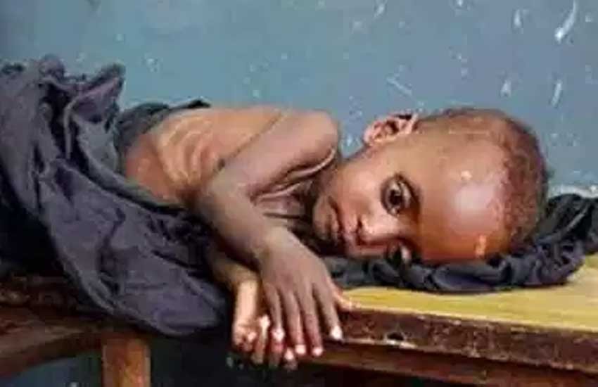 कुपोषण नैनिहाल