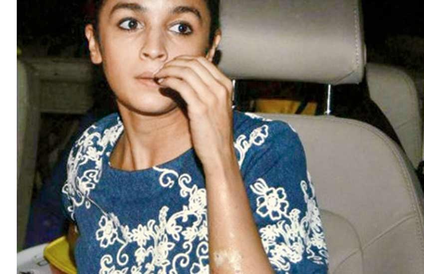 alia bhatt, alia bhatt burn, alia bhatt latest image, alia bhatt latest news, alia bhatt gallary