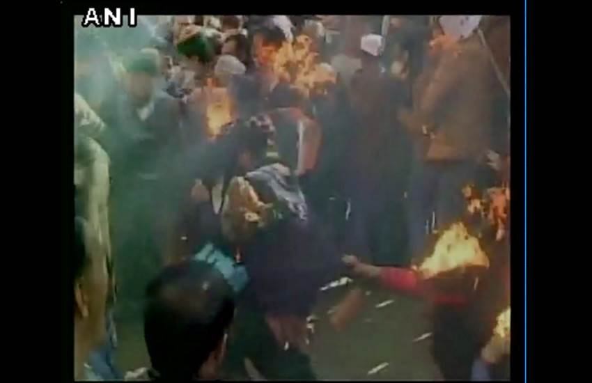 Congress worker, suffers burns, congress protest, #NationalHerald, Shimla protest, कांग्रेस कार्यकर्ता झुलसा, विरोध प्रदर्शन, नेशनल हेराल्‍ड, पुतला फूंका