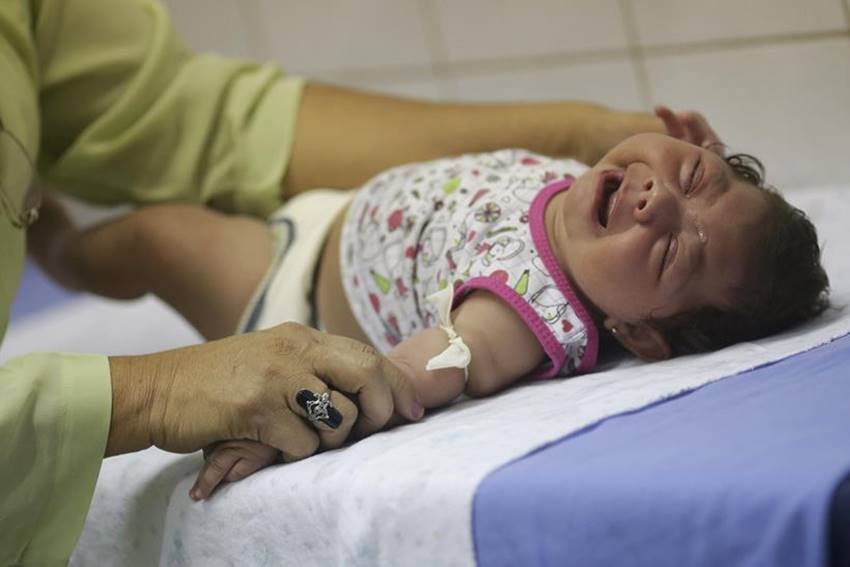 zika virus microcefalia zika zika virus microcefalia