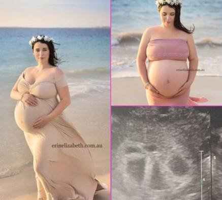 Pregnant woman, australian woman, Royal Hobart Hospital, Woman gives birth to 5 babies, kim tucci, australian woman kim tucci