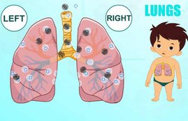 weak lungs, pollution, weak lungs of children, delhi news, air pollution, health news