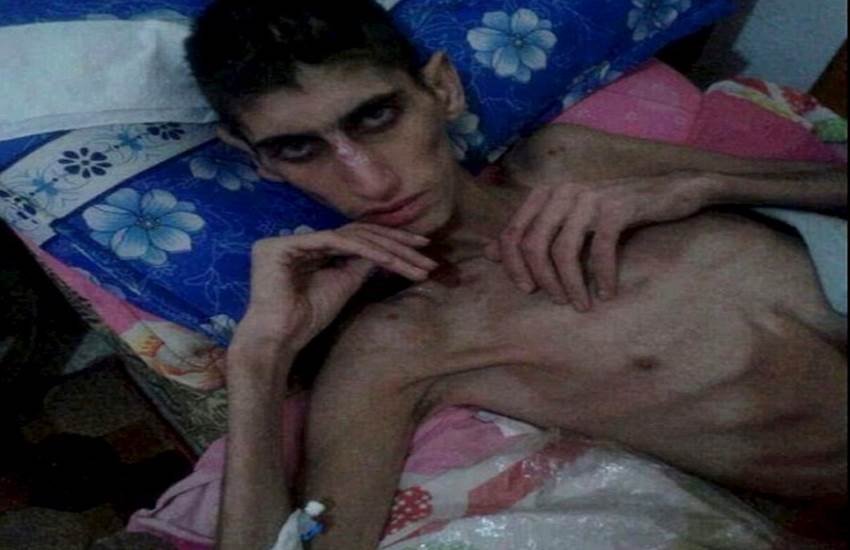 Horror of the starving, eat cats, eat dogs, eat grass, food supplie, Syrians trapped, ISIS news, Bashar Al Assad, besieged villages, isis syria, सीरिया, भुखमरी, घास, कुत्‍ता, बिल्‍ली, फूड सप्‍लाई, खाद्य आपूर्ति, बशर अली असद, आईएसआईएस, सीरियाई विद्रोही, latest syria news, news in hindi, hindi news