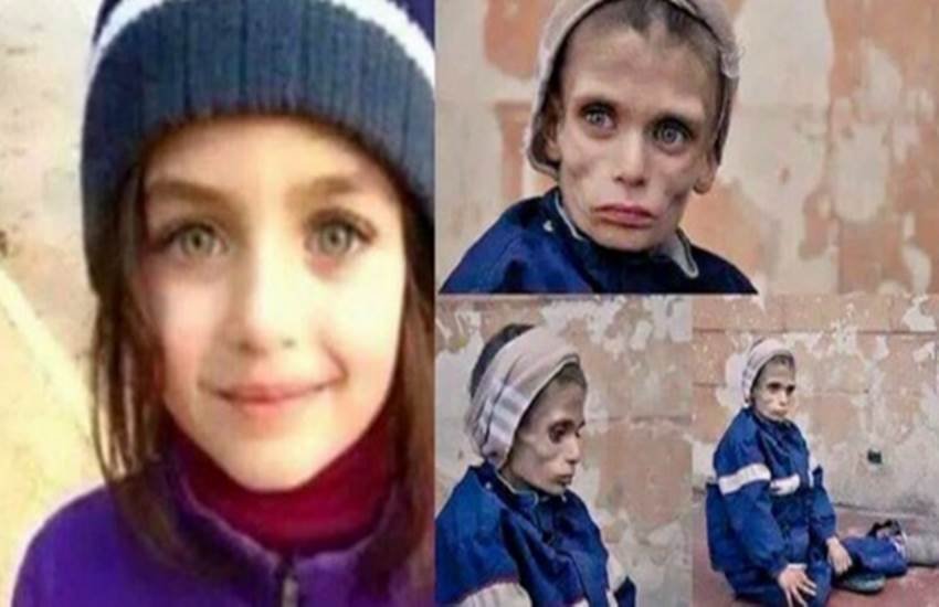 Horror of the starving, eat cats, eat dogs, eat grass, food supplie, Syrians trapped, ISIS news, Bashar Al Assad, besieged villages, isis syria, सीरिया, भुखमरी, घास, कुत्‍ता, बिल्‍ली, फूड सप्‍लाई, खाद्य आपूर्ति, बशर अली असद, आईएसआईएस, सीरियाई विद्रोही, latest syria news, news in hindi, hindi news