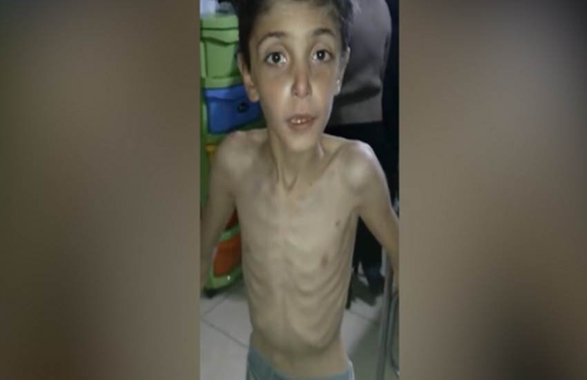 Horror of the starving, eat cats, eat dogs, eat grass, food supplie, Syrians trapped, ISIS news, Bashar Al Assad, besieged villages, isis syria, सीरिया, भुखमरी, घास, कुत्‍ता, बिल्‍ली, फूड सप्‍लाई, खाद्य आपूर्ति, बशर अली असद, आईएसआईएस, सीरियाई विद्रोही, latest syria news, news in hindi, hindi news