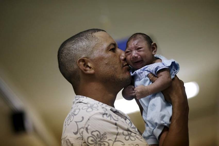 zika virus microcefalia zika zika virus microcefalia