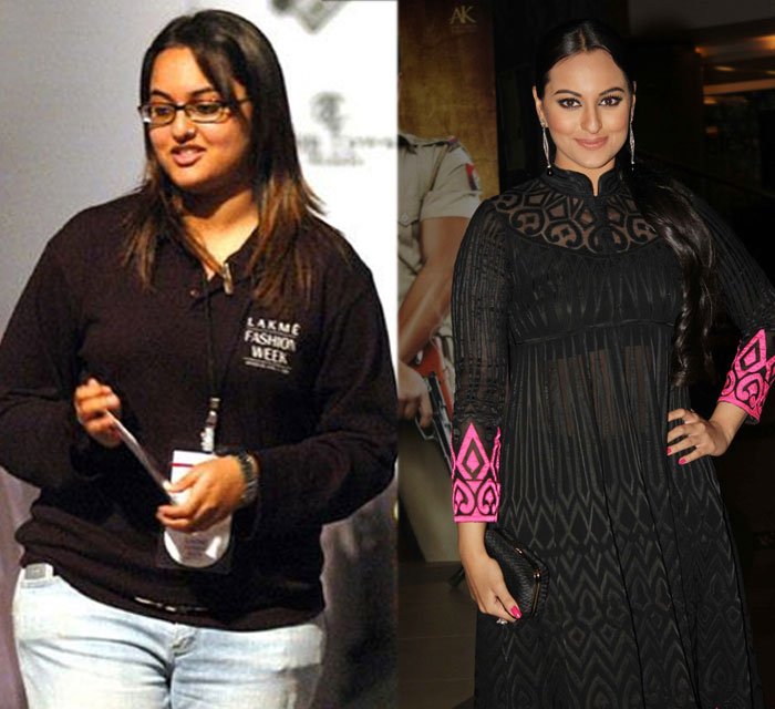 Anant ambani, bhumi pednekar, sonam kapoor, arjun kapoor, alia bhatt, sonakshi sinha, sonam kapoor, khushi kapoor, sridevi daughter, jahnavi kapoor, parineeti chopra, jackyy bhagnani, karan johar, arjun kapoor fat, alia bhatt fat, sonam kapoor fat, sobakshi sinha fat, sonam kapoor fat, parineeti chopra fat, jackyy bhagnani fat, karan johar fat, मुकेश अंबानी, अनंत अंबानी, सोनम कपूर, सिंगर अदनान सामी, सिद्धार्थ माल्या, अर्जुन कपूर, सोनाक्षी सिन्हा, भूमि पडनेकर, खुशी, श्रीदेवी, आलिया भट्ट, नितिन गडकरी, श्रीदेवी, करण जौहर