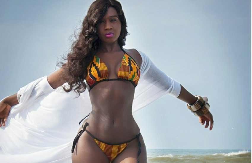actress Princess Shyngle, actress Princess Shyngle PHOTOS, Princess Shyngle hot photos, actress Princess Shyngle bikini, kidney disease, 22-INCH waist, 24-year-old actress, actress Princess Shyngle in hospital