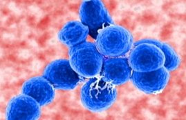 spinal meningitis, spinal meningitis Africa, spinal meningitis symptoms, spinal meningitis treatment, spinal meningitis contagious, Health
