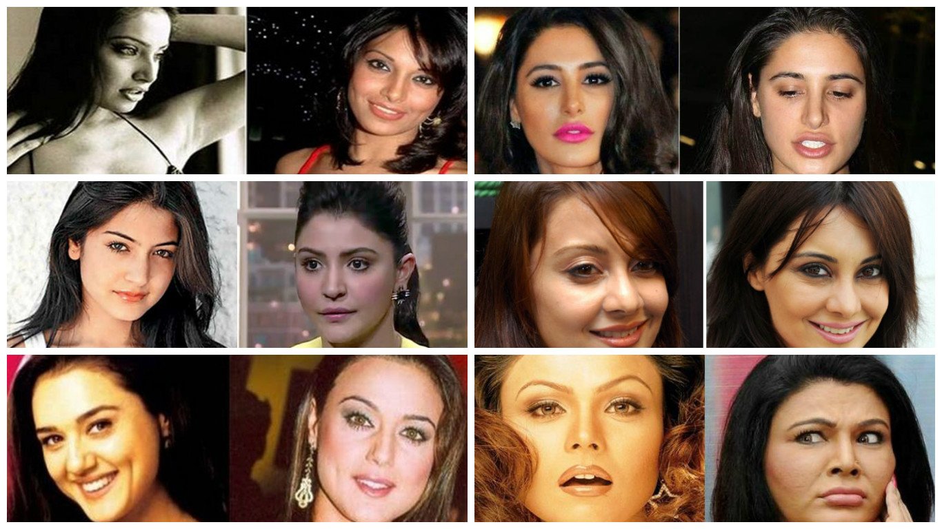 deepika padukon cosmetic surgery, hema malini, kangna ranaut surgery, Rakhi sawant surgery, Gauhar khan surgery, madhuri dixit surgery, shridevi surgery, nargis fakhri surgery, aishwarya rai bachchan surgery, bollywood actresses surgery, isha deol surgery, kaitrina kaif surgery