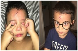 mom turns cut into harry potter scar, mommy can fix this imgur, harry potter scar boy