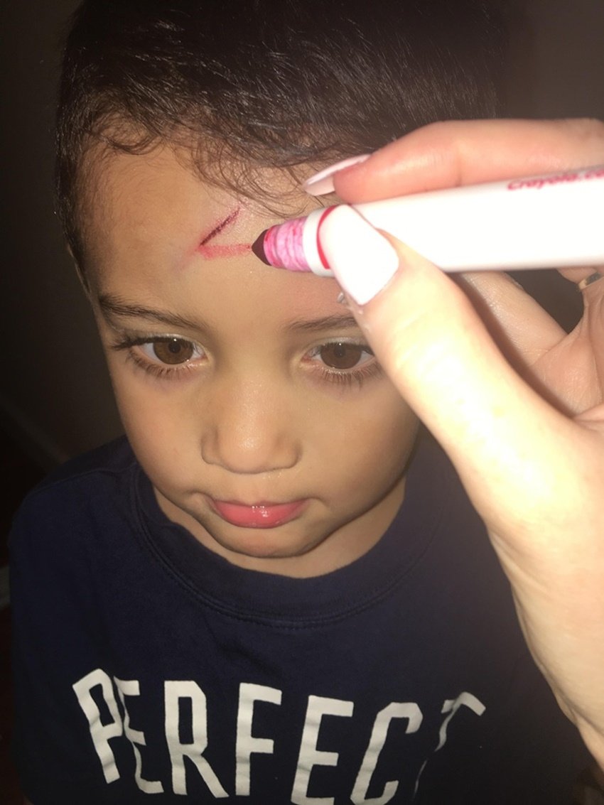 mom turns cut into harry potter scar, mommy can fix this imgur, harry potter scar boy