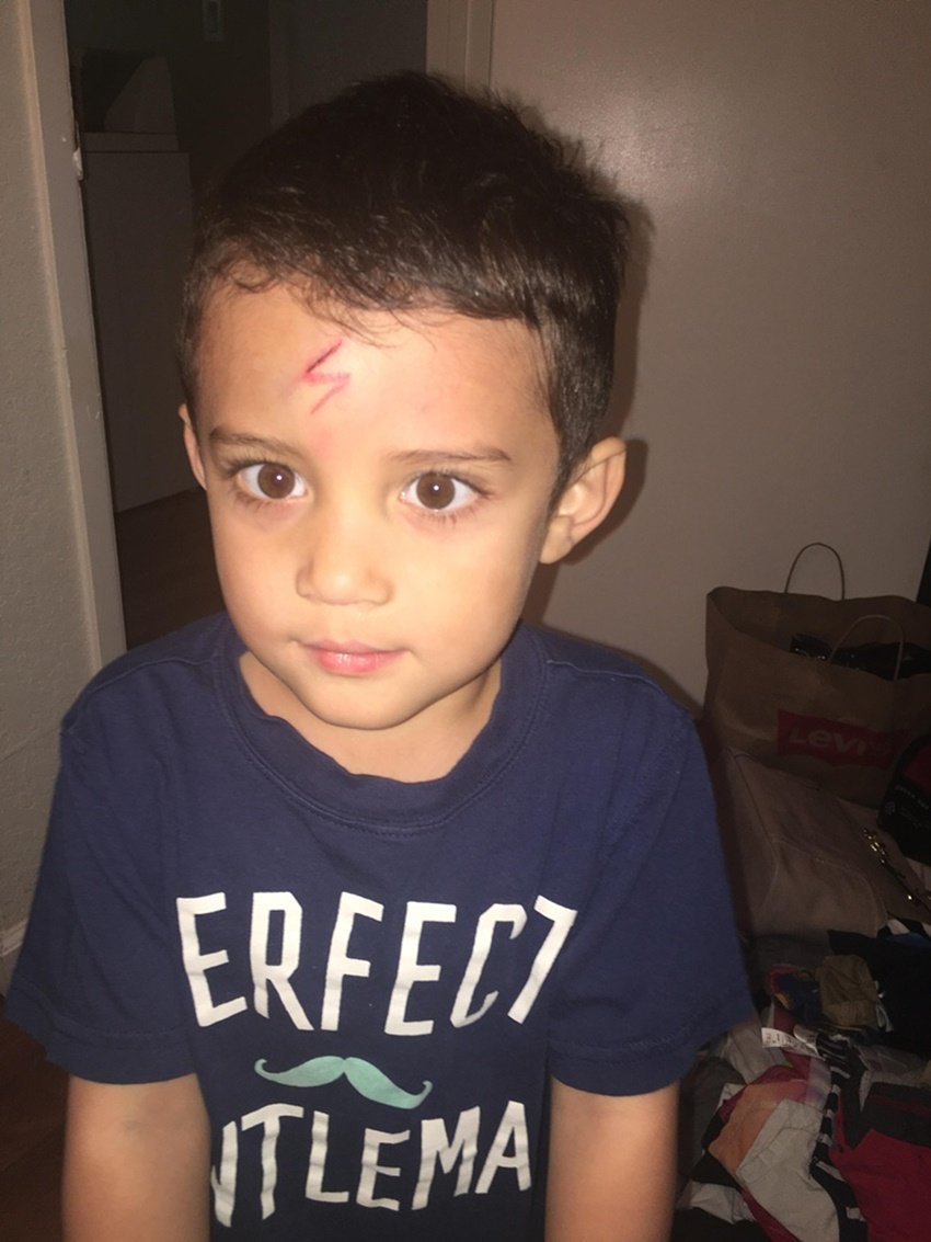 mom turns cut into harry potter scar, mommy can fix this imgur, harry potter scar boy