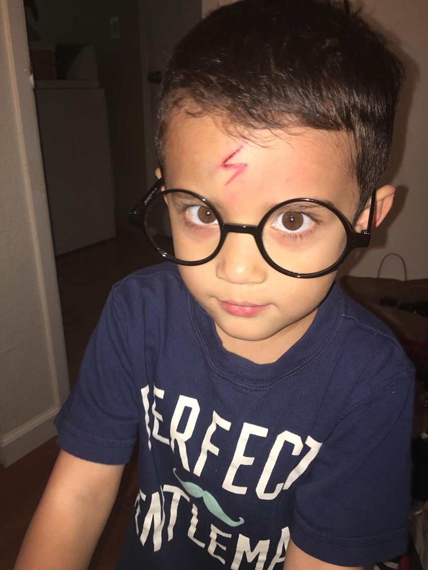 mom turns cut into harry potter scar, mommy can fix this imgur, harry potter scar boy