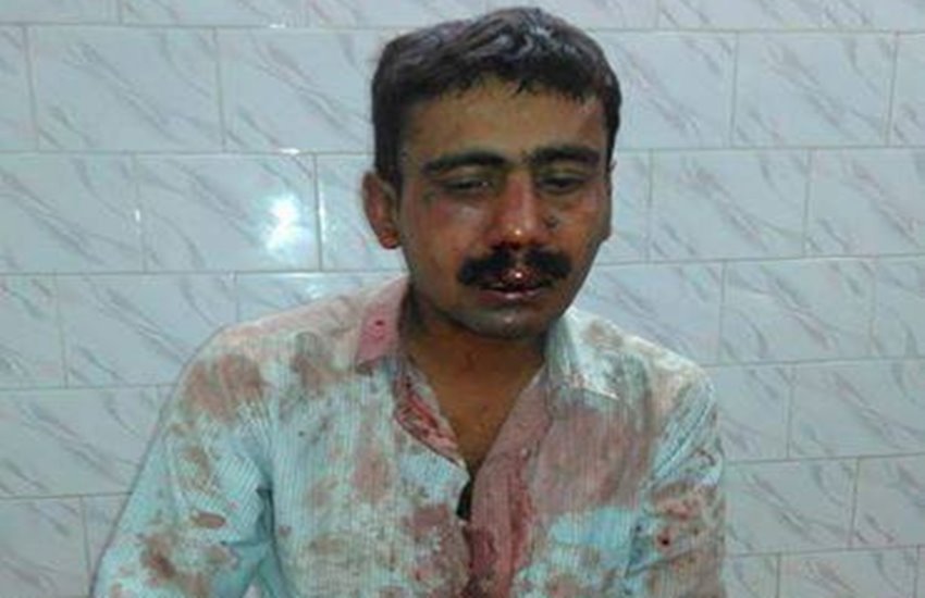 Patna Telegraph, Patna Telegraph Staff, Patna Telegraph Rakesh Singh, Patna Telegraph road rage, Patna Telegraph Employee, Patna Telegraph Staff Thrashed