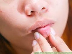 होंठों के कालेपन को दूर करना है तो अपनाएं ये Beauty tips