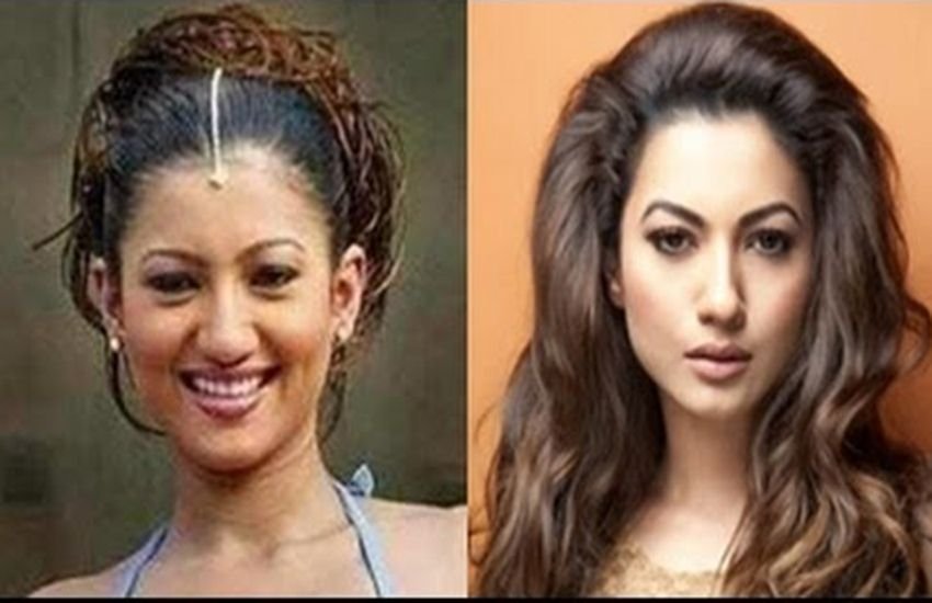priyanka chopra surgery, anushka sharma surgery, deepika padukon cosmetic surgery, hema malini, kangna ranaut surgery, Rakhi sawant surgery, Gauhar khan surgery, madhuri dixit surgery, shridevi surgery, nargis fakhri surgery, aishwarya rai bachchan surgery, bollywood actresses surgery, isha deol surgery, kaitrina kaif surgery