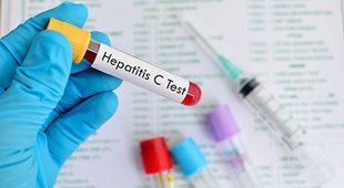hepatitis,Hepatitis C,Dangerous,America,हेपेटाइटिस,हेपेटाइटिस सी,खतरनाक,अमेरिका