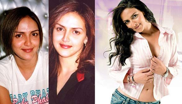 priyanka chopra surgery, anushka sharma surgery, deepika padukon cosmetic surgery, hema malini, kangna ranaut surgery, Rakhi sawant surgery, Gauhar khan surgery, madhuri dixit surgery, shridevi surgery, nargis fakhri surgery, aishwarya rai bachchan surgery, bollywood actresses surgery, isha deol surgery, kaitrina kaif surgery