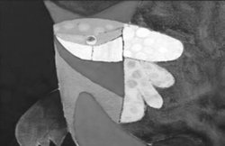 व्यंग्य : महापुरुषाई के खतरे