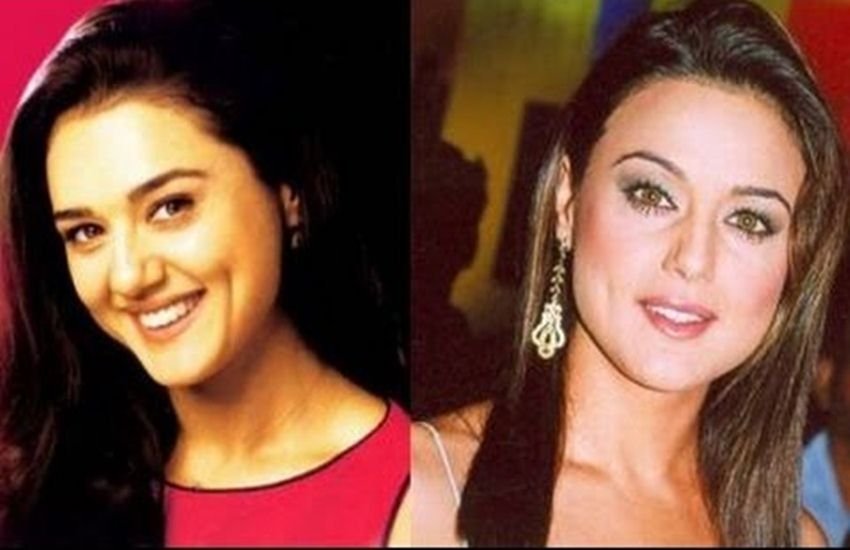 priyanka chopra surgery, anushka sharma surgery, deepika padukon cosmetic surgery, hema malini, kangna ranaut surgery, Rakhi sawant surgery, Gauhar khan surgery, madhuri dixit surgery, shridevi surgery, nargis fakhri surgery, aishwarya rai bachchan surgery, bollywood actresses surgery, isha deol surgery, kaitrina kaif surgery