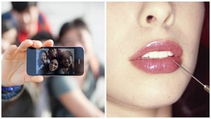 Lip Surgery,lip implant,US,American Society of Plastic Surgeons, LifeStyle