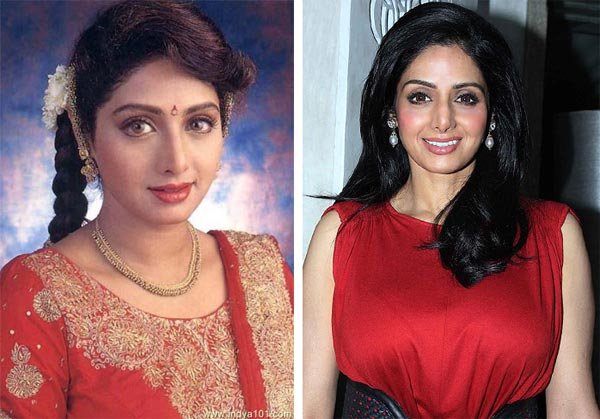 priyanka chopra surgery, anushka sharma surgery, deepika padukon cosmetic surgery, hema malini, kangna ranaut surgery, Rakhi sawant surgery, Gauhar khan surgery, madhuri dixit surgery, shridevi surgery, nargis fakhri surgery, aishwarya rai bachchan surgery, bollywood actresses surgery, isha deol surgery, kaitrina kaif surgery