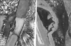 उर्मिला शुक्ल की कहानी : कउआ हंकनी