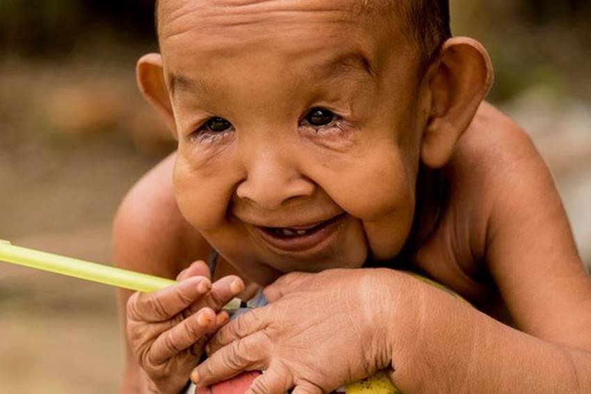4 Years Old Boy, 4 Years Old looks 80 years, Progeria, progeria disease, progeria disorder, real life paa, Bayezid Hossain, Bayezid Hossain from Bangladesh