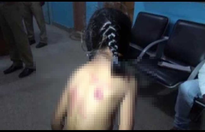 Bengaluru, Bengaluru news, Bengaluru Latest News, Bengaluru Teacher, Girl Beaten, Bengaluru Girl Beaten, Girl Beaten in Bengaluru, Girl Beaten by Leather Belt, Hindi News, Jansatta