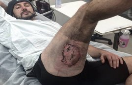 Gareth Clear, iphone, iphone explode