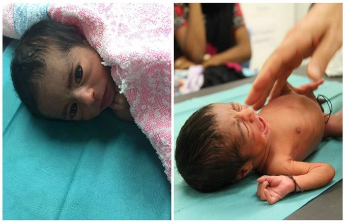 30 घंटे के रेस्क्यू ऑपरेशन में बचाए गए 5 दिन के जुड़वा भाई, सामने आईं तस्वीरें