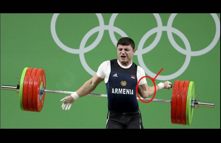 Rio Olympics 2016, Rio Olympics, Andranik Karapetyan, Andranik Karapetyan elbow, Rio Olympics news, Rio Olympics Live