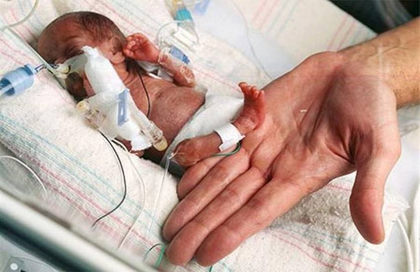 Baby Emilia, World's smallest baby, premature birth
