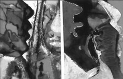 व्यंग्य- बलिहारी गुरु आपनो