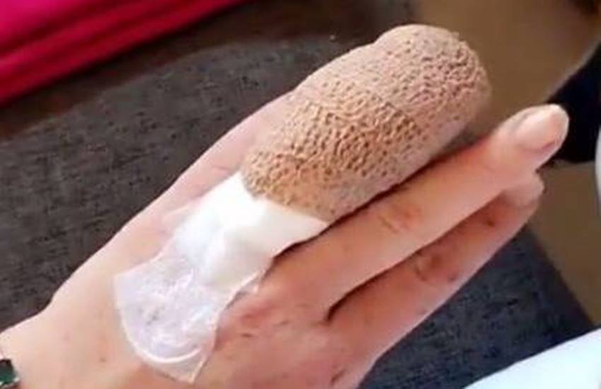 अभिनेत्री ने अपनी घायल उंगली की तस्वीर स्नैपचैट पर शेयर की है।