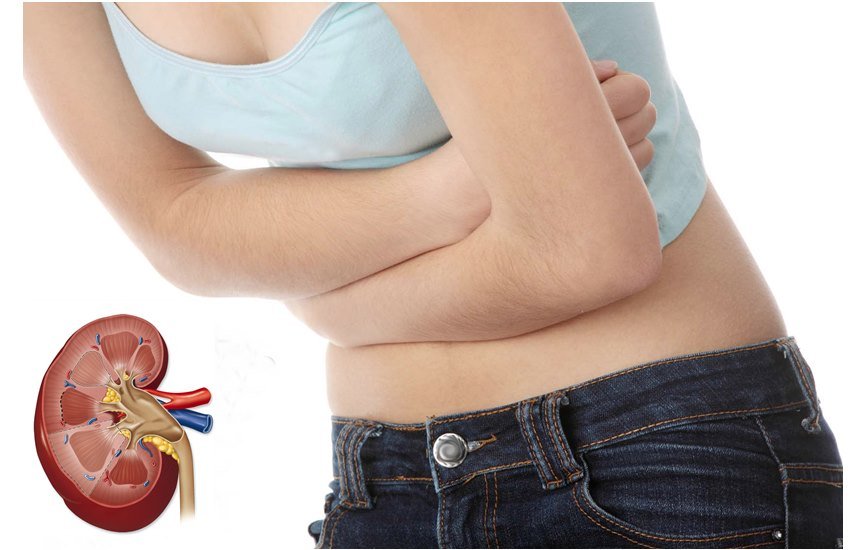 Kidney Stones, Kidney Stones Pain, Kidney Stone Symptoms, Kidney Stone Home Remedies, Home Remedies For Kidney Stone, Stone pain, Stone Home Remedies, Natural Remedies for Kidney Stone, Health tips