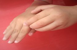 अगर आपको भी हो रही है खुजली तो ध्यान दें, हो सकती है ये बड़ी बीमारी