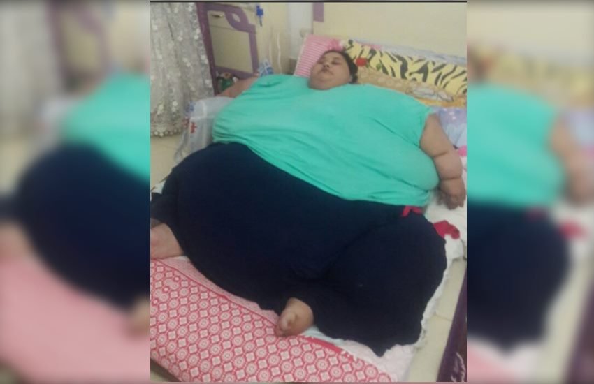 इमान एलिफेंटाइसिस नामक बीमारी से पीड़ित हैं। इस बीमारी में पिंडलियों में काफी सूजन आ जाती है। (फोटो: Twitter)