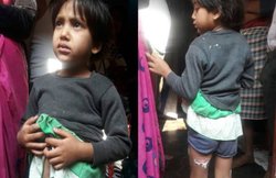 माँ ने बिस्तर में पेशाब करने पर 5 वर्षीय बेटी को चिमटे से जलाया, कहा- अब सीख जाएगी सबक