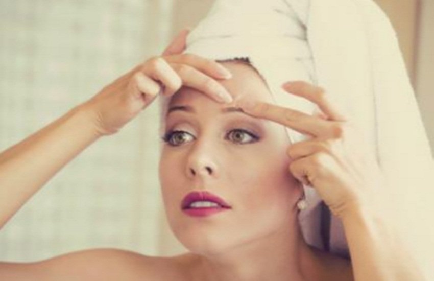 pimple treatment, Face Tips