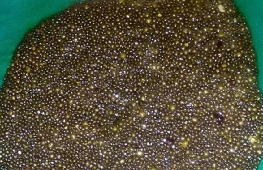 इस तस्वीर का इस्तेमाल केवल प्रतीक के तौर पर किया गया है।